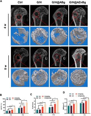 Zinc-energized dynamic hydrogel accelerates bone regeneration via potentiating the coupling of angiogenesis and osteogenesis